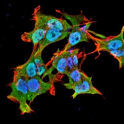 AlphaA Crystallin/CRYAA Antibody (1H3.B8), Novus Biologicals 50ug; Unlabeled:Antibodies,